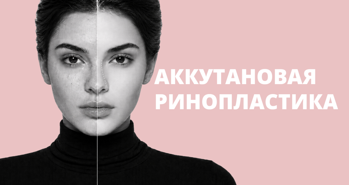 Обложка: аккутановая ринопластика
